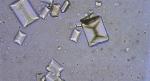 Fotomicrografia demonstrando cristalúria de estruvita